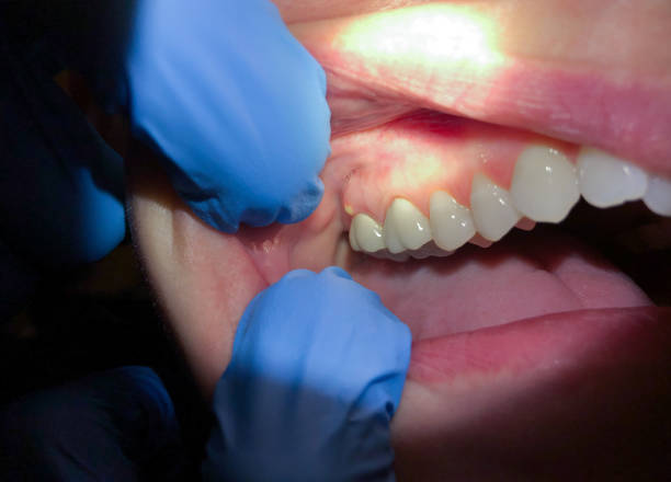 Best Weekend Emergency Dentist in Inverness Highlands South, FL